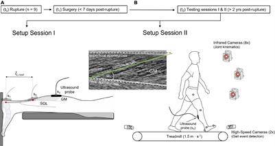 Altered Gastrocnemius Contractile Behavior in Former Achilles Tendon Rupture Patients During Walking